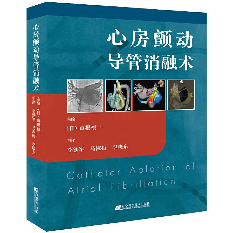 心房颤动导管消融术