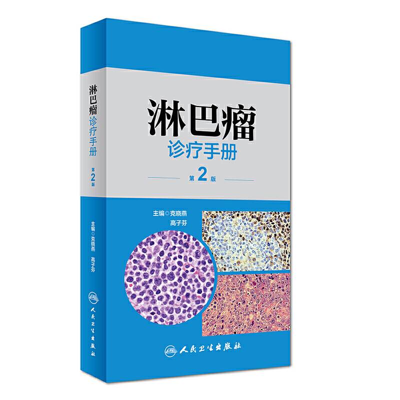 淋巴瘤诊疗手册