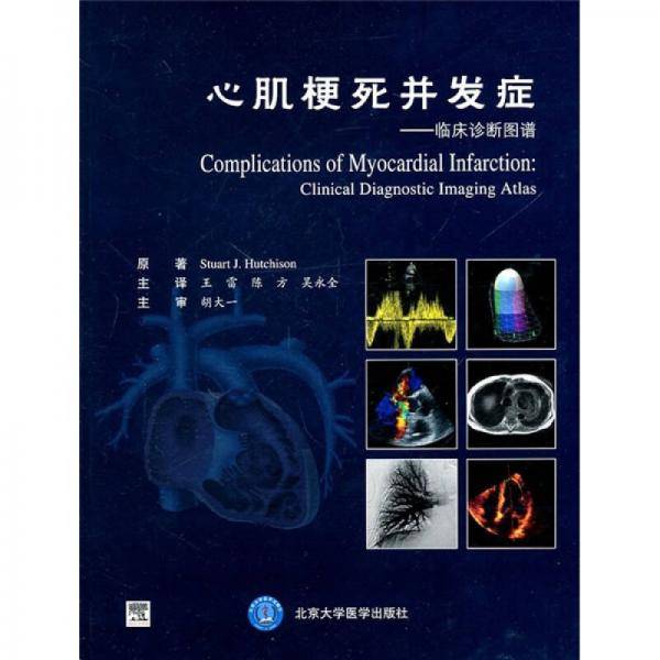 心肌梗死并发症