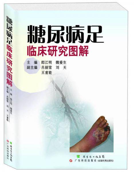 糖尿病足临床研究图解