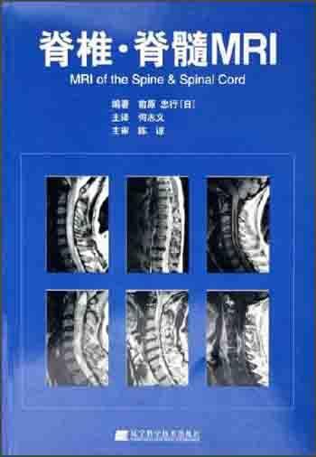 脊椎・脊髓MRI