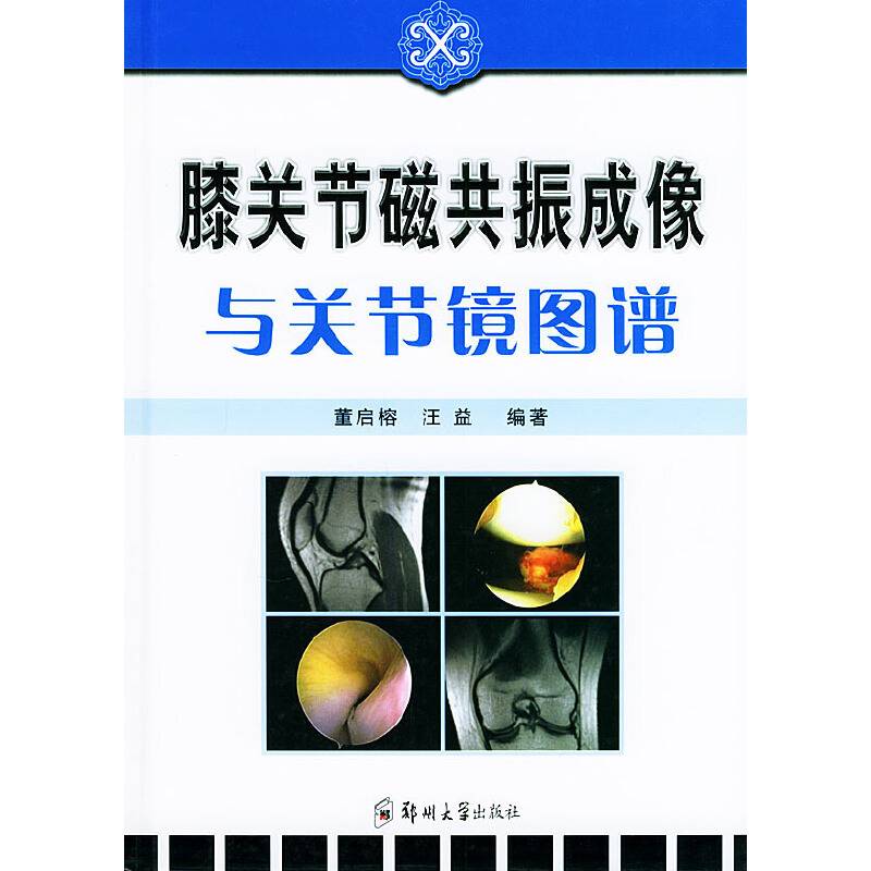 膝关节磁共振成像与关节镜图谱