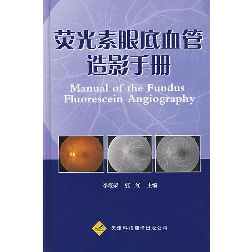 荧光素眼底血管造影手册