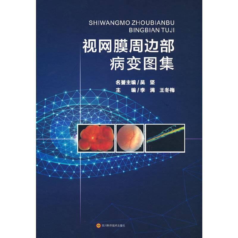 视网膜周边部病变图集