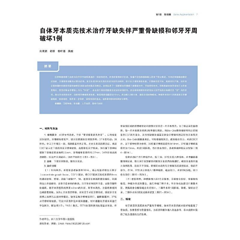 中国口腔种植临床精萃