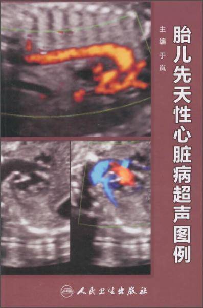 胎儿先天性心脏病超声图例