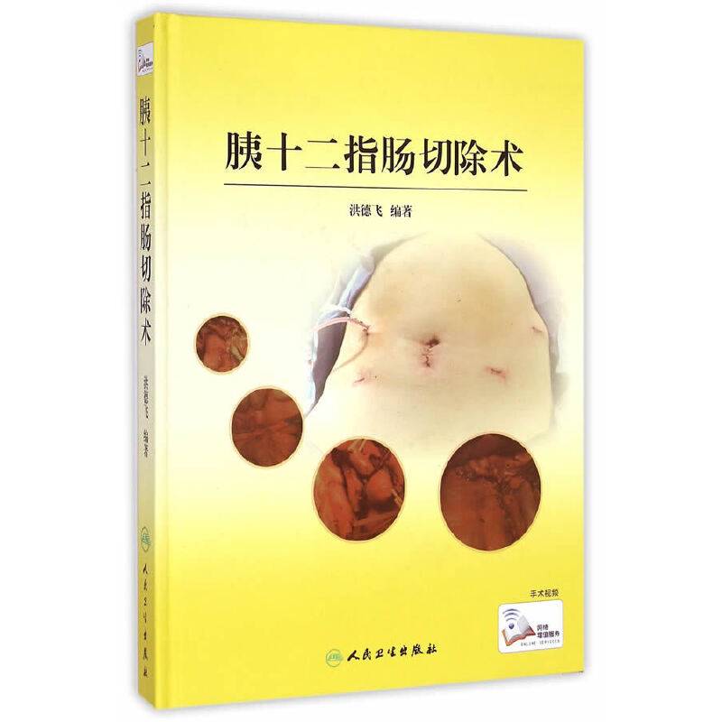 胰十二指肠切除术