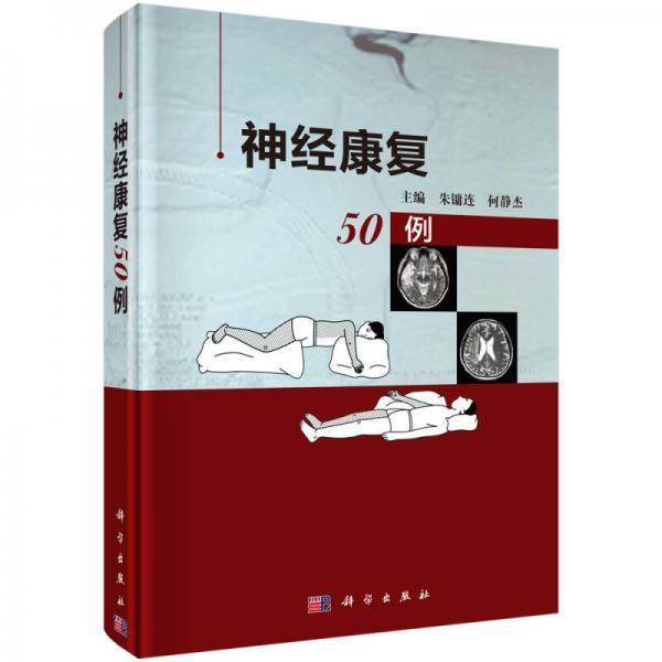 神经康复50例(精)