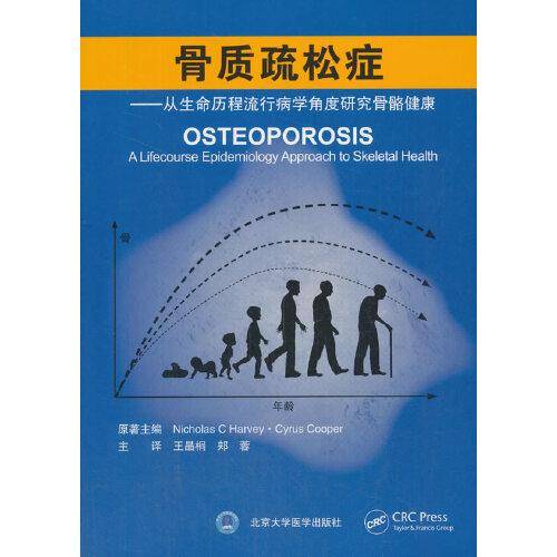 骨质疏松症――从生命历程流行病学角度研究骨骼健康