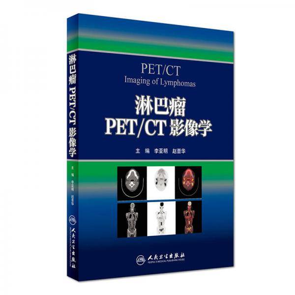 淋巴瘤PET/CT影像学