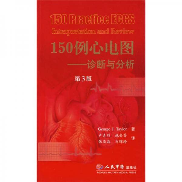 150例心电图