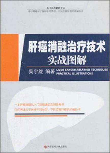 肝癌消融治疗技术实战图解