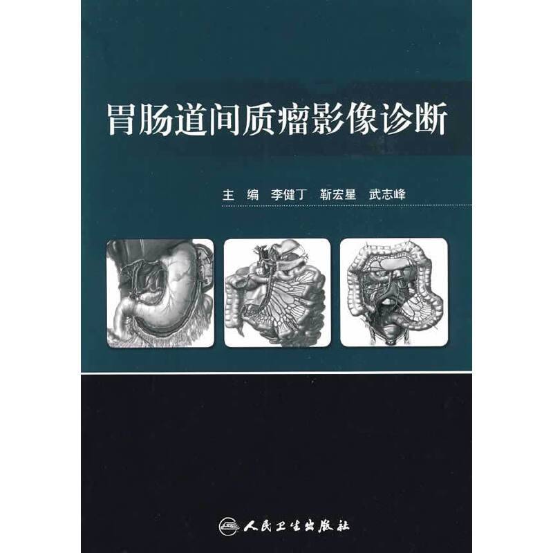 胃肠道间质瘤影像诊断