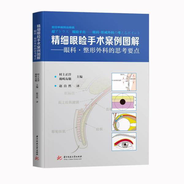 精细眼睑手术案例图解
