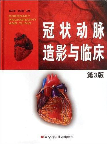 冠状动脉造影与临床