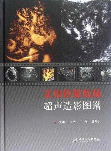 实用肝脏疾病超声造影图谱