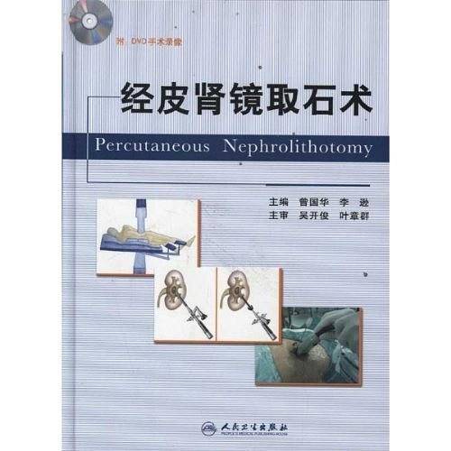 经皮肾镜取石术