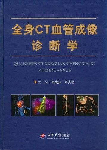 全身CT血管成像诊断学