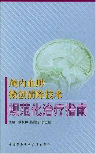 颅内血肿微创清除技术规范化治疗指南