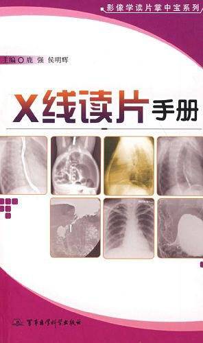 X线读片手册