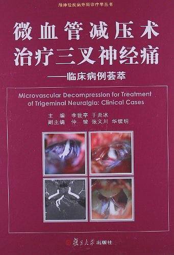 微血管减压术治疗三叉神经痛