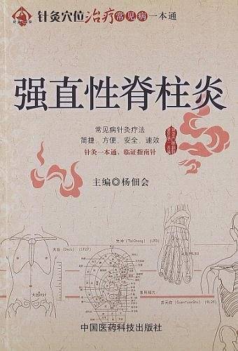 强直性脊柱炎