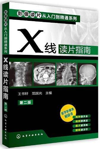 X线读片指南
