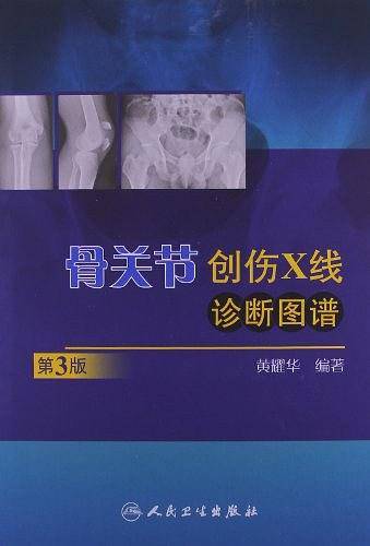 骨关节创伤X线诊断图谱