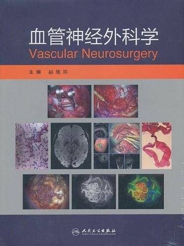 血管神经外科学