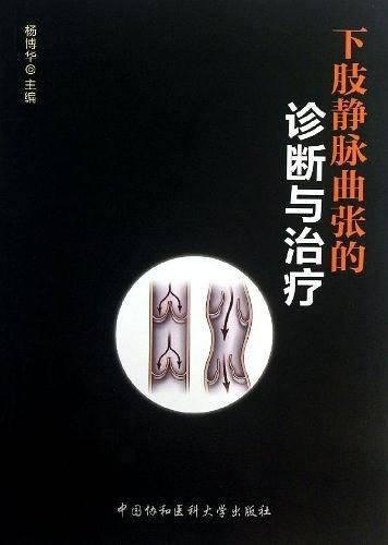 下肢静脉曲张的诊断与治疗