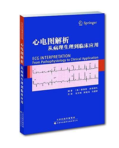 心电图解析