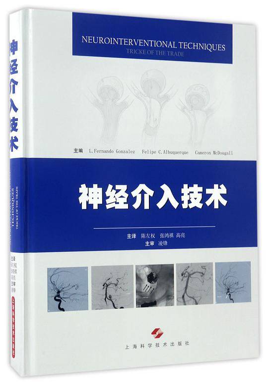 神经介入技术