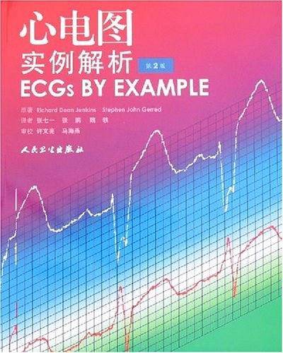 心电图实例解析