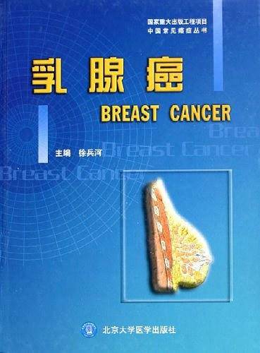 乳腺癌/中国常见癌症丛书