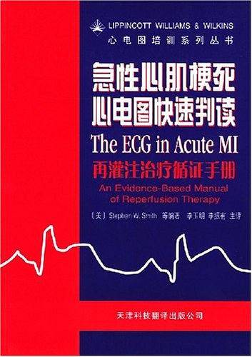 急性心肌梗死心电图快速判读