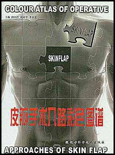 皮瓣手术入路彩色图谱