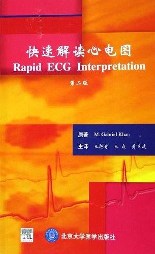 快速解读心电图