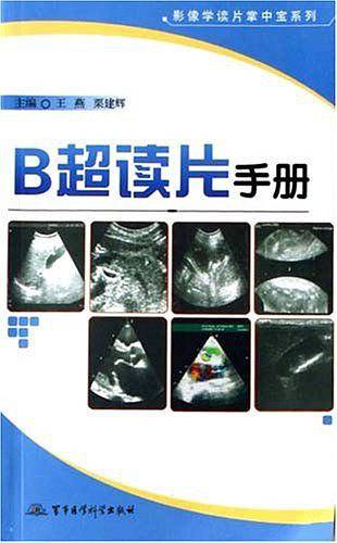 B超读片手册