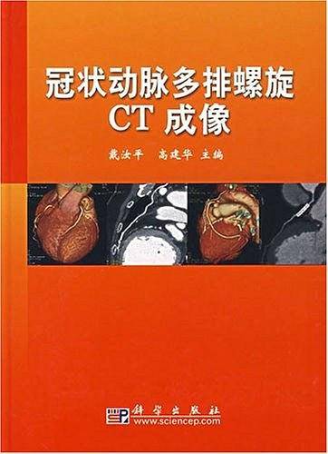 冠状动脉多排螺旋CT成像