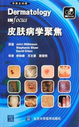 皮肤病学聚焦（中英文对照）