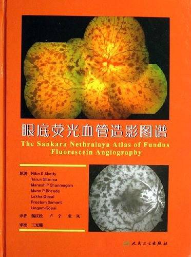眼底荧光血管造影图谱