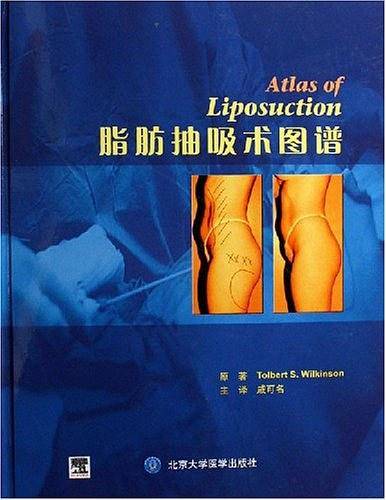 脂肪抽吸术图谱