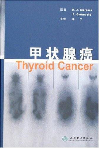 甲状腺癌