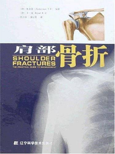 肩部骨折