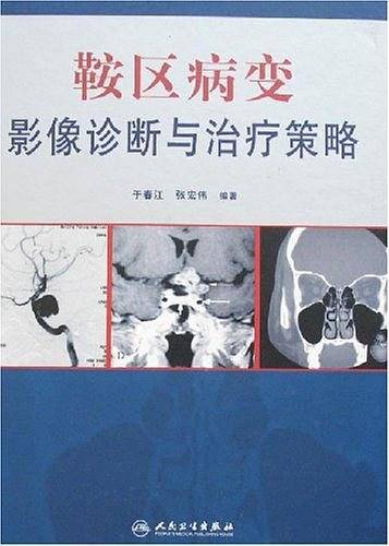 鞍区病变影像诊断与治疗策略