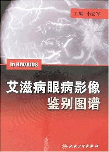 艾滋病眼病影像鉴别图谱