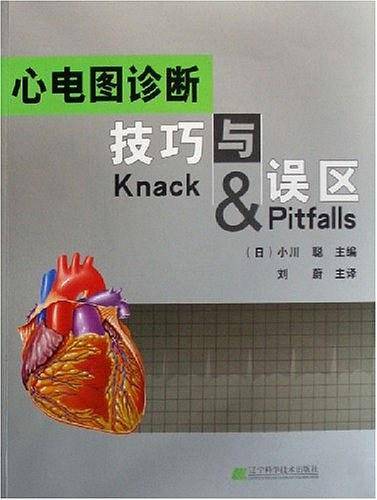 心电图诊断技巧与误区