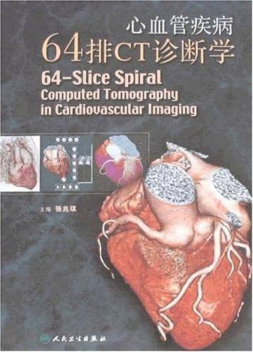 心血管疾病64排CT诊断学