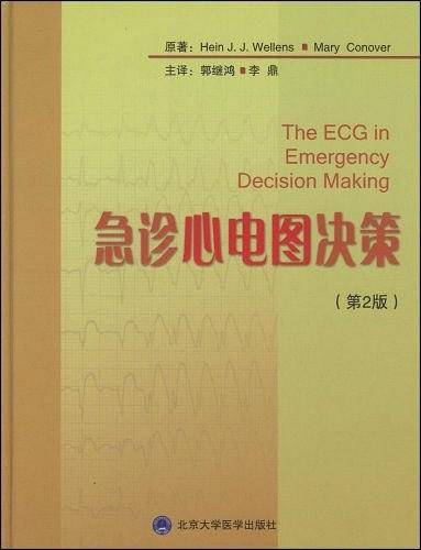 急诊心电图决策