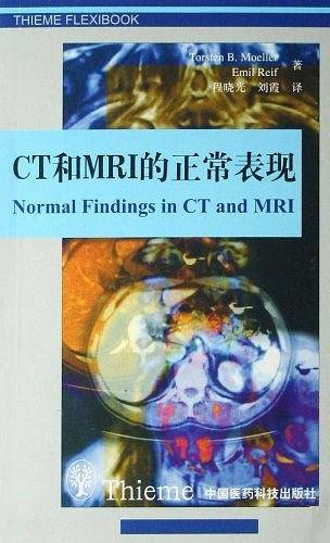 CT和MRI的正常表现